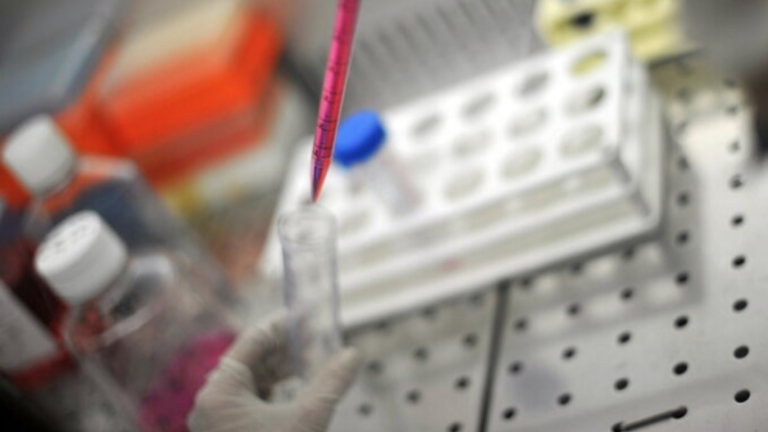Università Cattolica e Bambino Gesù: diagnosi Long Covid con IA