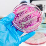 Coltura batterica su un disco di Petri