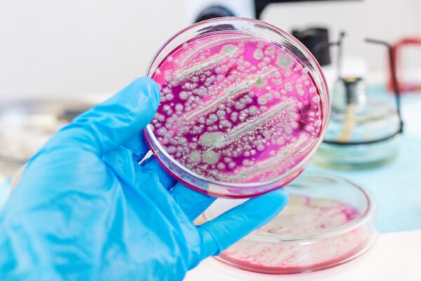 Tumore al colon-retto: scoperta rivoluzionaria dell’Università di Trento Coltura batterica su un disco di Petri