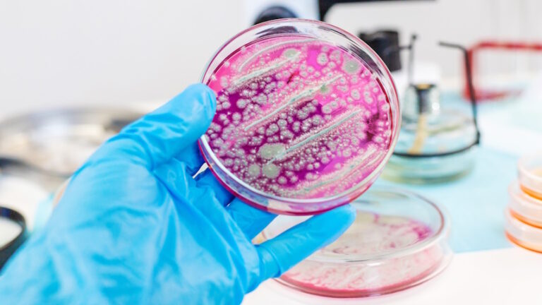 Coltura batterica su un disco di Petri