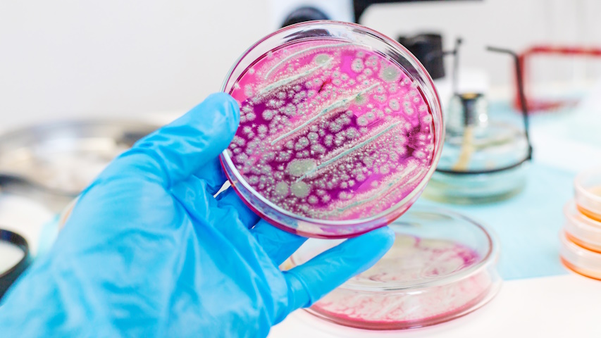 Coltura batterica su un disco di Petri