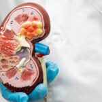 Medico tiene in mano un modello anatomico del rene