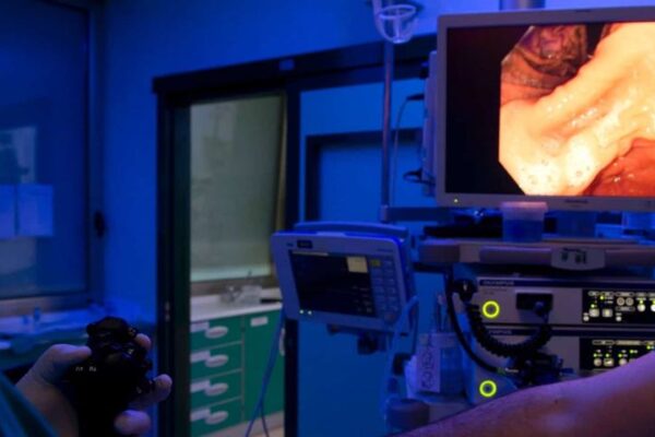 endoscopia