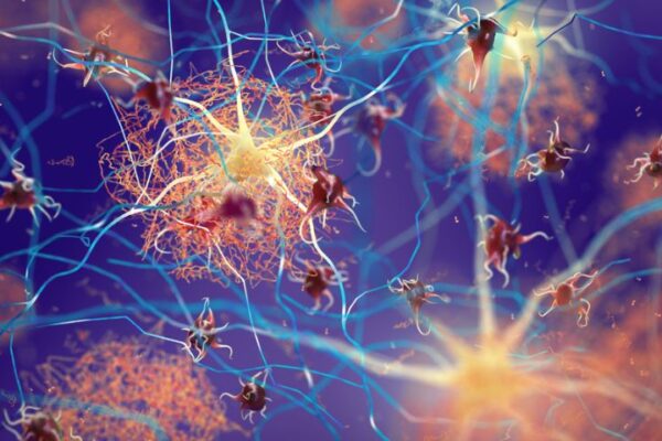 SCOPERTA Alzheimer