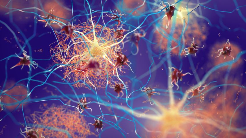 SCOPERTA Alzheimer